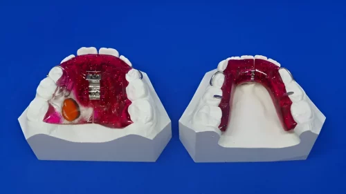 exemple de plaques amovibles dentaires posées sur des une moulure de fausses dents